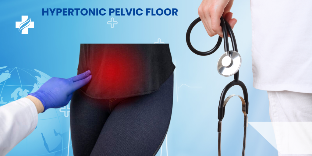HYPERTONIC PELVIC FLOOR