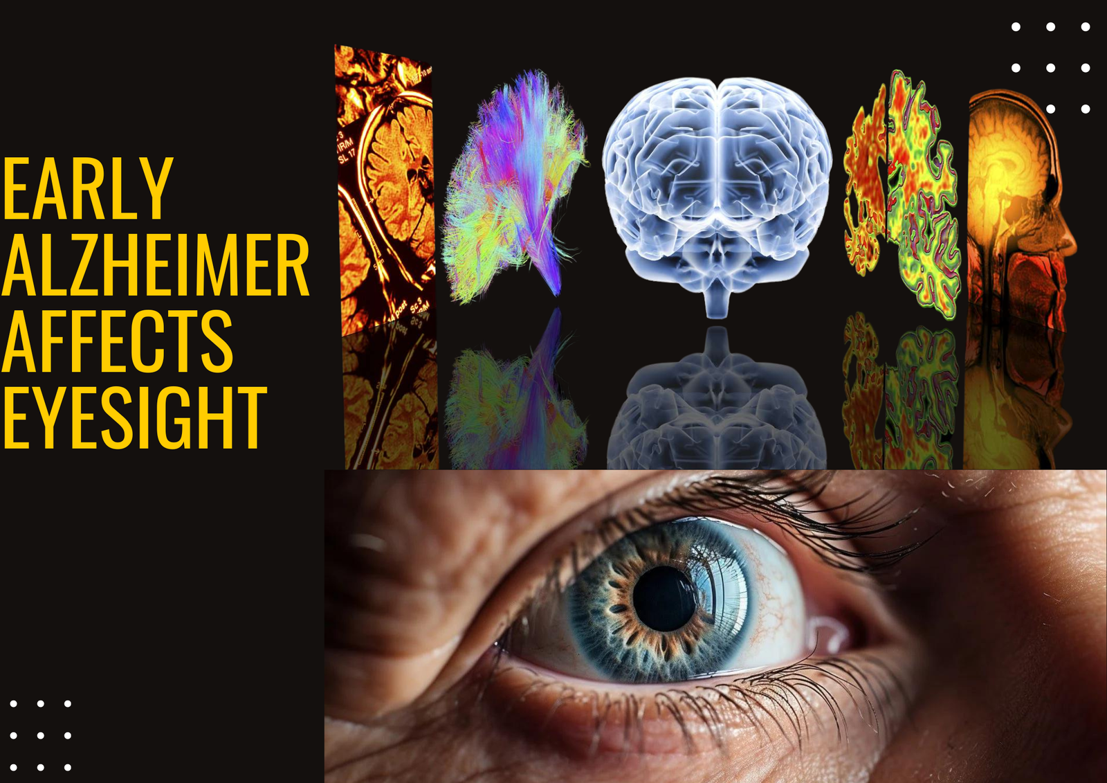 Early Alzheimer's Affects Eyesight