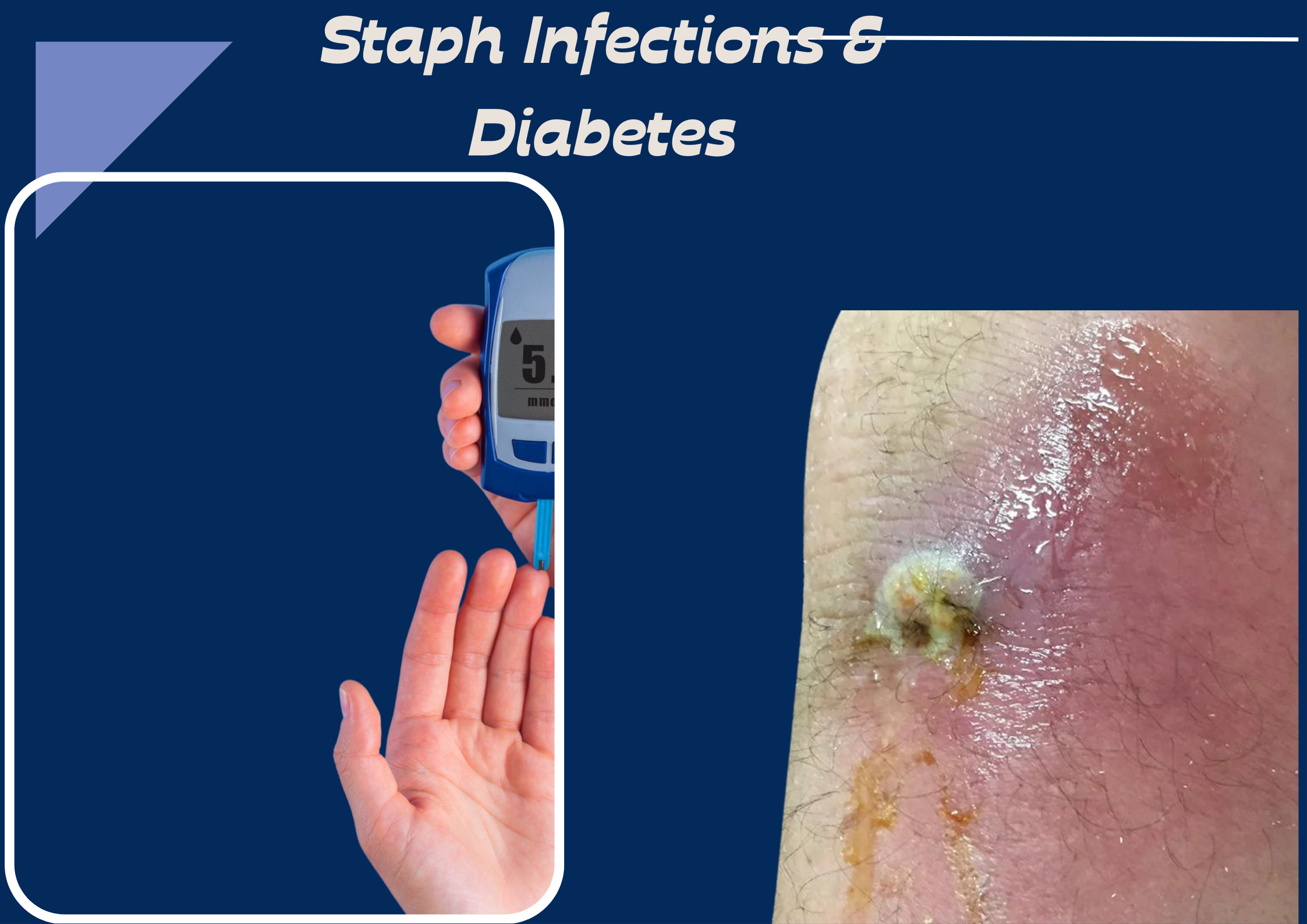 Combat Staph Infections with Confidence: Strategies for Diabetics