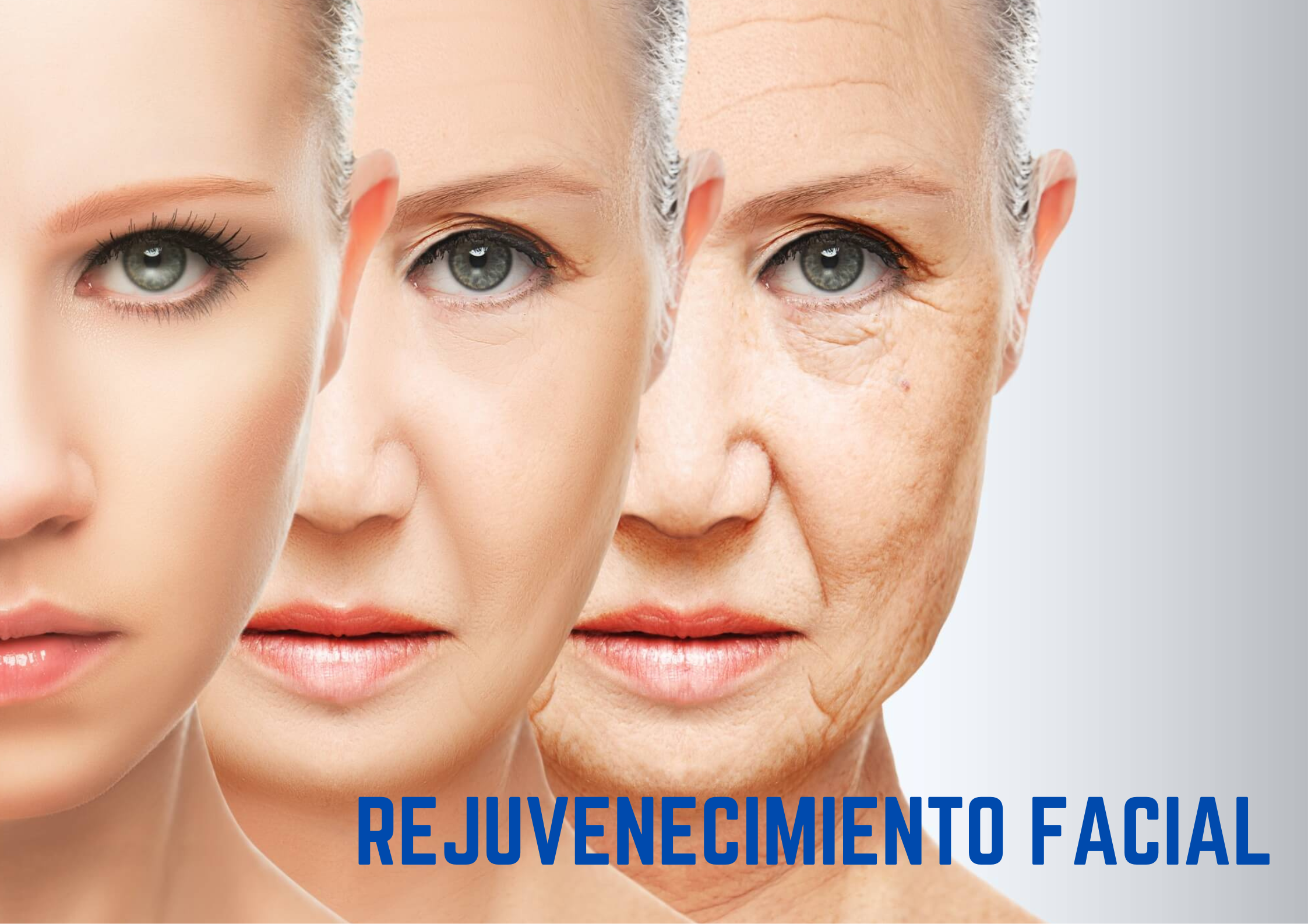 Rejuvenecimiento Facial